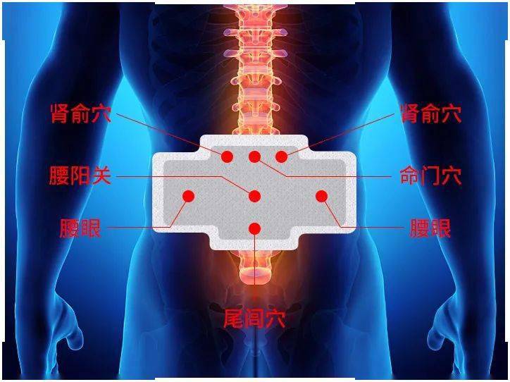 腰突腰肌勞損風(fēng)濕性腰痛找準(zhǔn)一個(gè)穴位每天一貼貼出鐵腰板兒從.